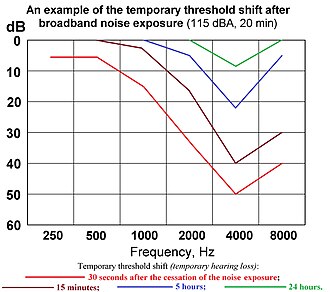 Diagram of temporary threshold shift over time.