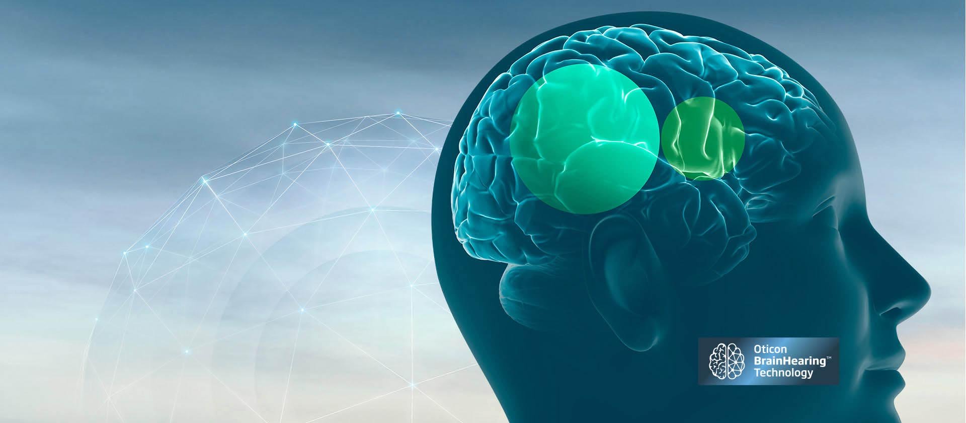 Illustration of Oticon BrainHearing technology highlighting brain areas responsible for hearing and sound processing.