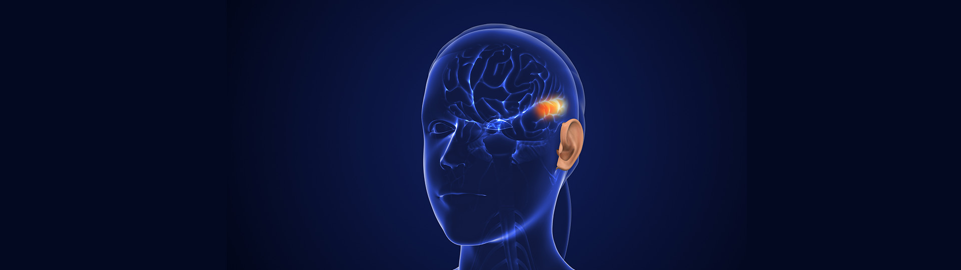 Transparent head illustration with implantable hearing device highlighted near the brain.