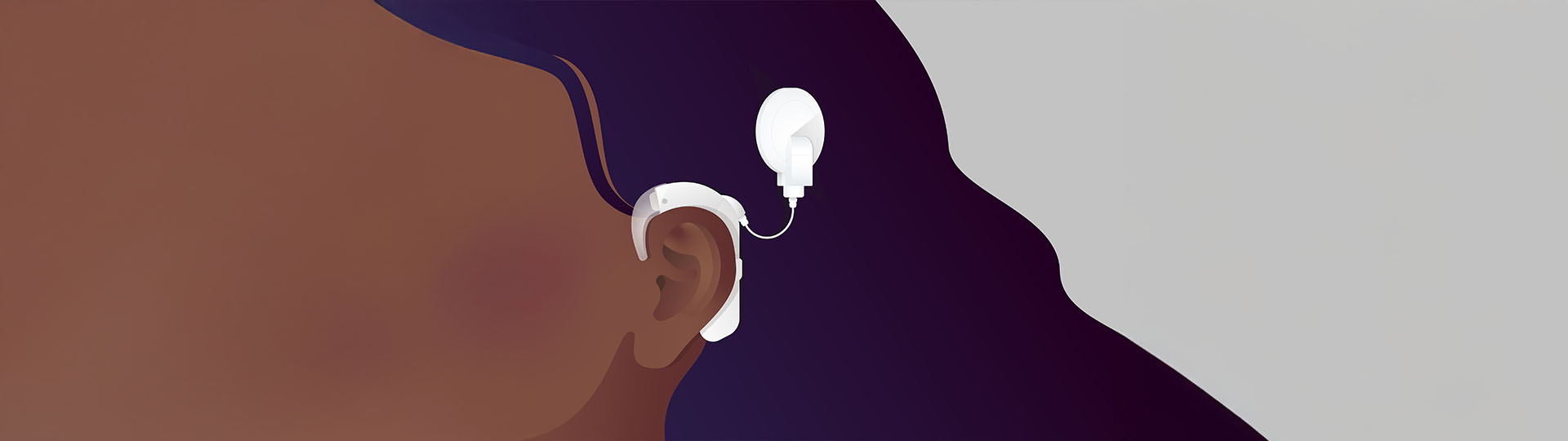 Cochlear implant and hearing aid worn behind the ear.
