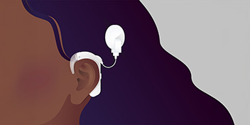 Cochlear implant behind the ear for hearing support