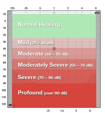 Degrees of hearing loss include mild (25–40 dB), moderate (40–55 dB), moderately severe (55–70 dB), severe (70–90 dB), and profound (over 90 dB), detailed using decibel and frequency levels.