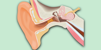 Cross-section diagram of the human ear illustrating earwax buildup within the ear canal.