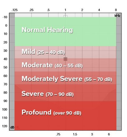 degrees of hearing loss go from mild, moderate, moderately severe, severe, and profound