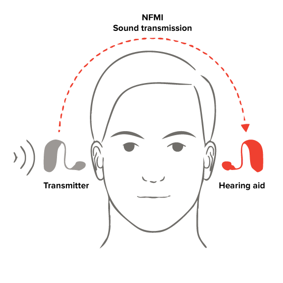 A hearing aid that picks up the sound from the transmitter and plays it in your better ear.