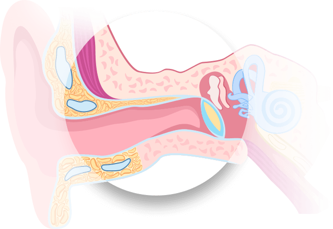 Cross-section diagram of the human ear displaying the outer, middle, and inner ear regions, including anatomical structures such as the eardrum, ossicles, cochlea, and surrounding tissues highlighted in pink and blue.