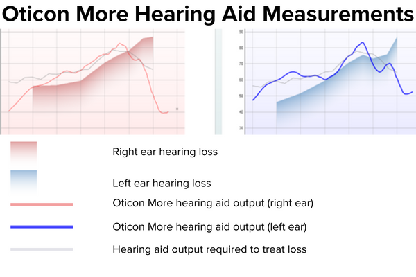 audiogram displaying right and left ear hearing loss, Oticon More hearing aid output for both ears, and output required to address hearing loss