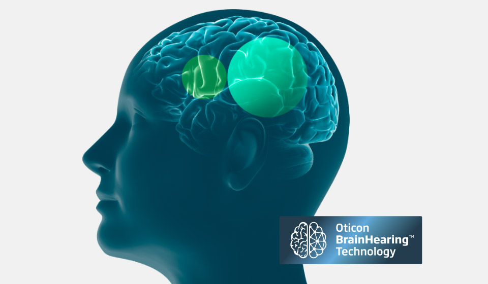Digital illustration of a human brain emphasizing auditory processing areas connected to Oticon BrainHearing™ technology.