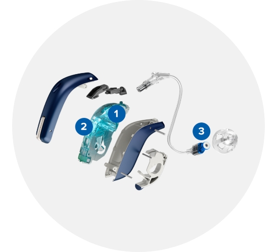 Exploded view of a hearing aid highlighting numbered components, including a blue outer shell, internal hardware, tubing, and a clear earpiece against a plain background.