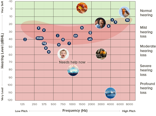 Audiogram chart illustrating sound frequencies (125–8000 Hz) and hearing levels (0–120 dBHL), categorizing hearing loss severity—normal, mild, moderate, severe, and profound—with labeled speech sounds, images, and 'Needs help now' marker.