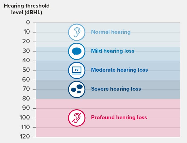 Niveaux de perte auditive illustrés par l’échelle de seuil auditif (dBHL) montrant l’audition normale, perte légère, modérée, sévère et profonde.